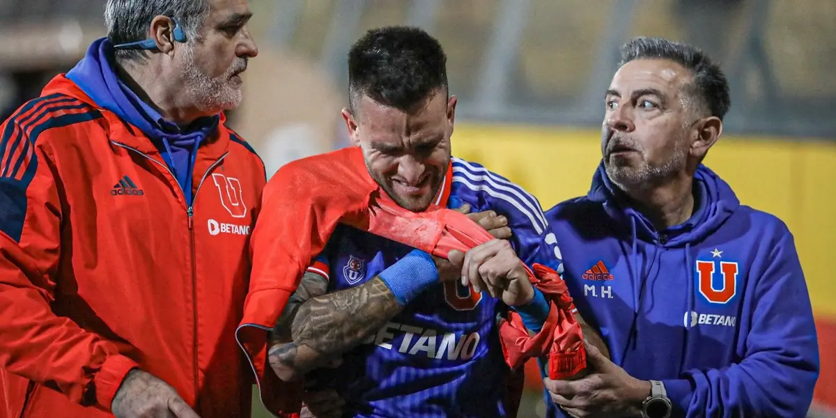 El zaguero central tuvo que salir de la cancha en los minutos finales ante Curicó Unido.